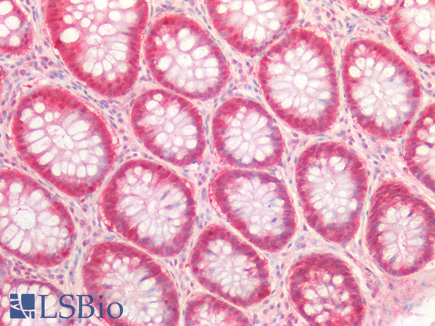 PathPlus™ Polyclonal Rabbit anti-Human MLPH / Melanophilin Antibody (IHC)