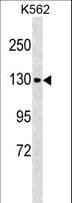 CHERP Antibody (aa877-903)