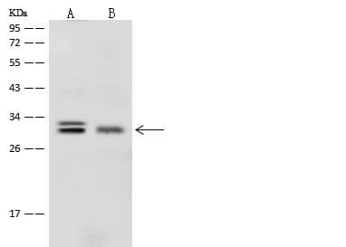PROSC Antibody