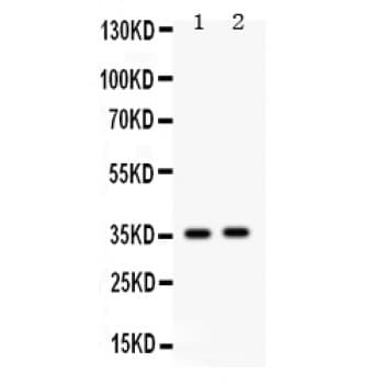 FOSB Antibody (aa264-291)