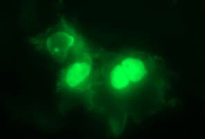 PARVB Antibody (clone OTI1B9)