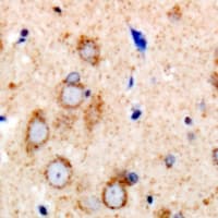 Polyclonal Rabbit anti-Human NOS3 / eNOS Antibody (C-Terminus, IHC, IF, WB)