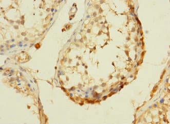 DHX32 Antibody