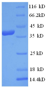 Human EIF4G1 / EIF4G Protein (Recombinant His)