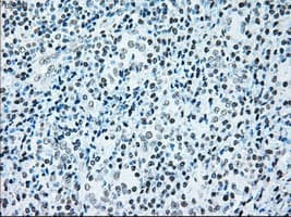 BRAF / B-Raf Antibody (clone OTI4C11)