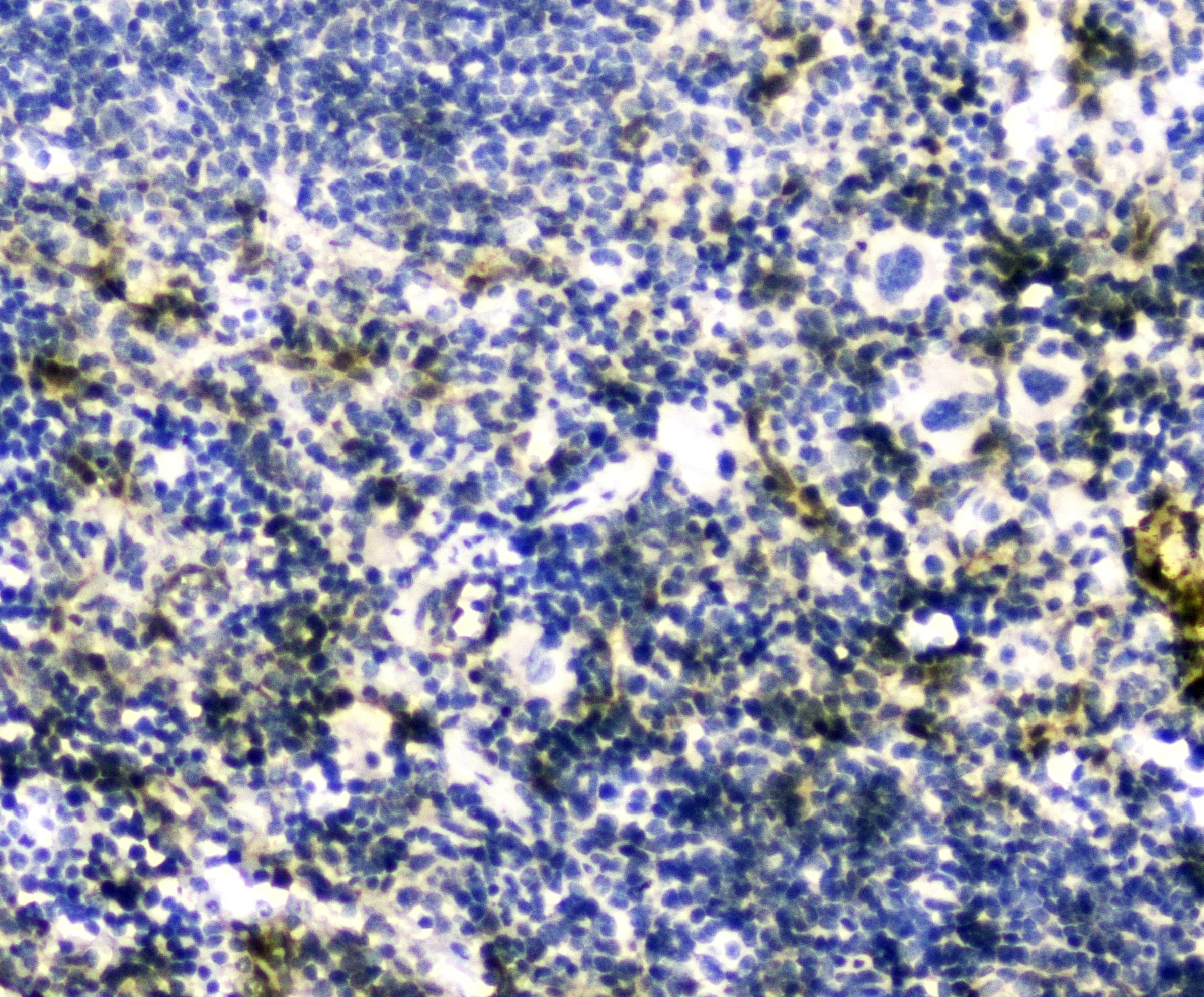 Polyclonal Rabbit anti-Human GLO1 / Glyoxalase I Antibody (IHC, WB)