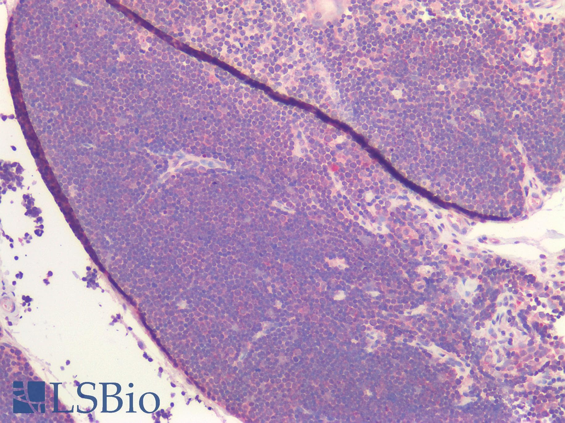IHC-plus™ ADORA2A/Adenosine A2A Receptor Antibody