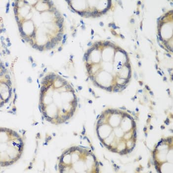 Polyclonal Rabbit anti-Human ACCS / ACS Antibody (IHC, IF, WB)