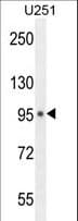 MICALL1 / MICAL-L1 Antibody (aa752-781)