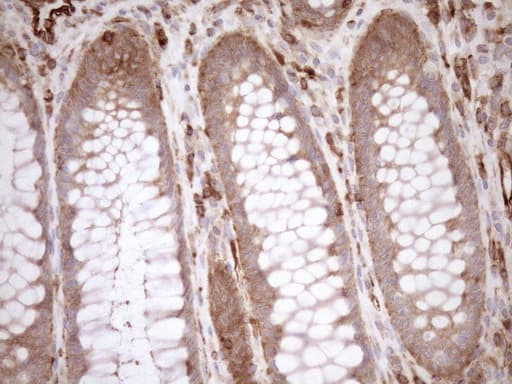Monoclonal Mouse anti-Human ASPDH Antibody (clone OTI4G8, IHC)