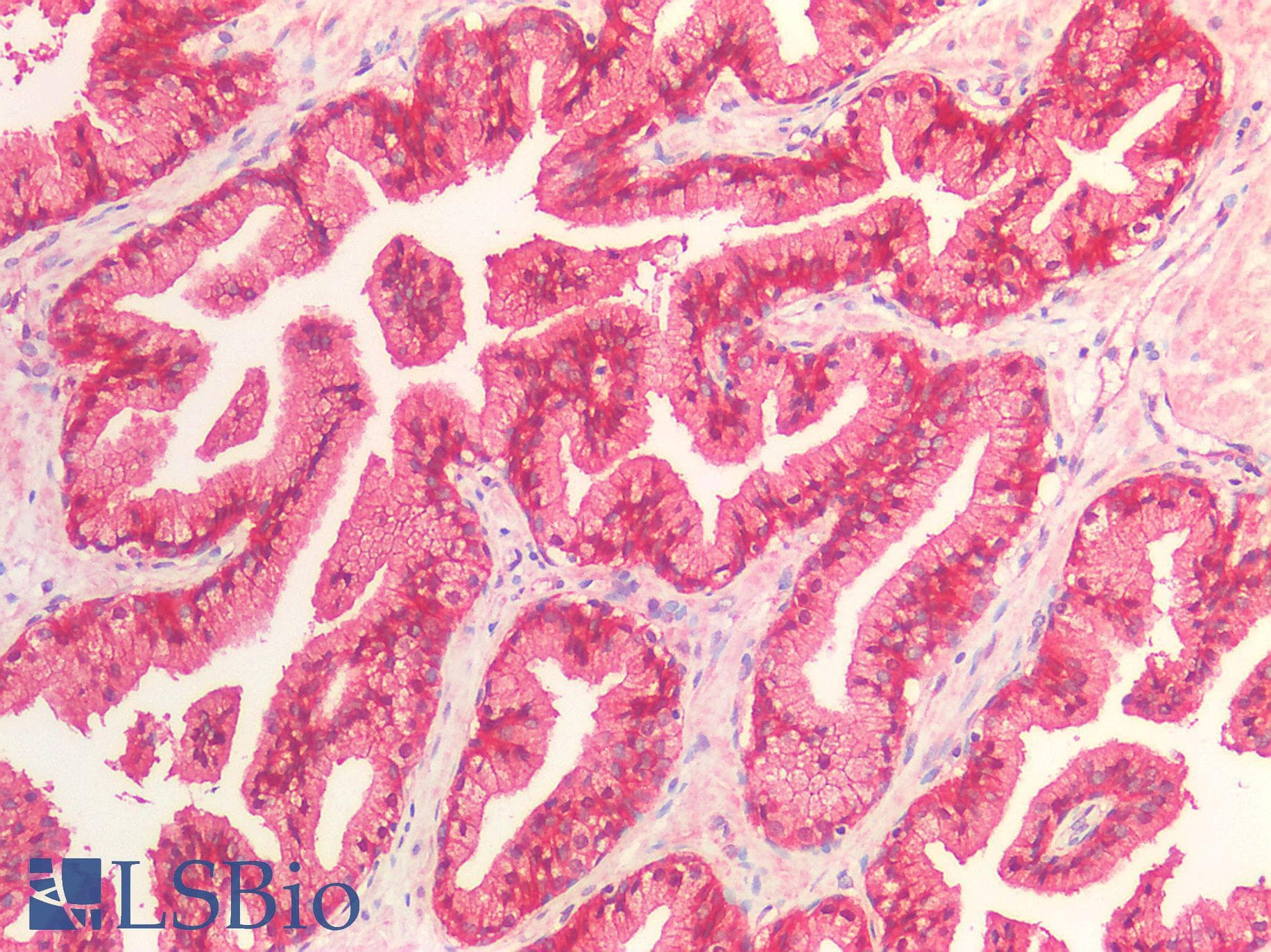 PathPlus™ CTNNB1 / Beta Catenin Antibody
