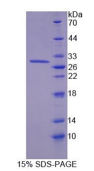 Human KLK12 / Kallikrein 12 Protein (Recombinant His-S)