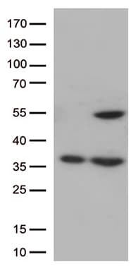 CDK15 / ALS2CR7 Antibody (clone OTI2D5)