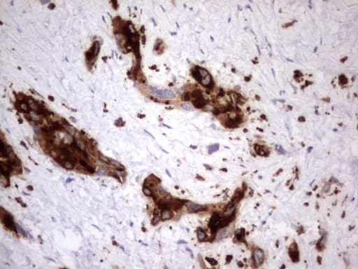 CEACAM5 / CD66e Antibody (aa35-680, clone OTI1D4)