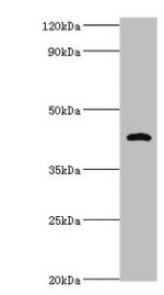 IHC-plus™ HP / Haptoglobin Antibody (aa 19-406)
