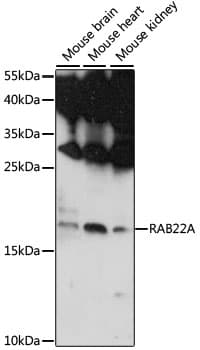 RAB22A / RAB22 Antibody