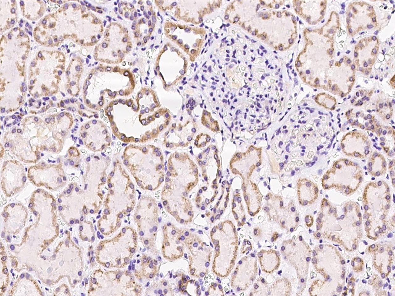 SUCLG1 / GALPHA Antibody