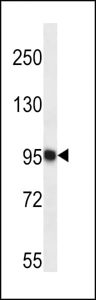 TRAPPC12 / TTC15 Antibody (aa579-608)