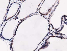 SQSTM1 Antibody (clone OTI5A2)