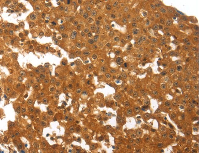OPG / Osteoprotegerin Antibody