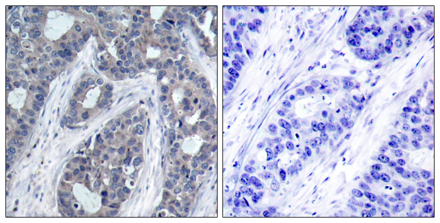 Polyclonal Rabbit anti-Human IRS1 Antibody (phospho-Ser636, IHC, IF, WB)