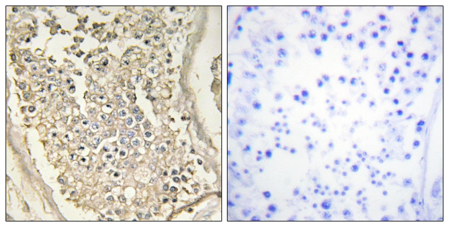 Polyclonal Rabbit anti-Human WC1 / ATP7B Antibody (IHC, IF)