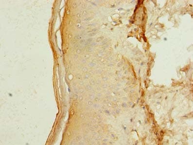 MEI1 Antibody