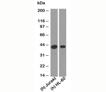 RUNX3 Antibody (clone RNX864)