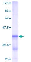 Human p16INK4a / CDKN2A Protein (Recombinant GST)