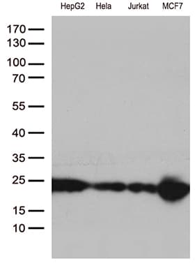 MGMT Antibody (clone OTI5A7)