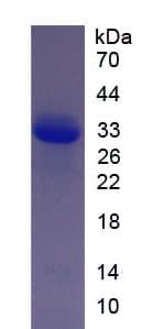 Human COL11A1 / Collagen XI Alpha 1 Protein (Recombinant His, N-Terminal)