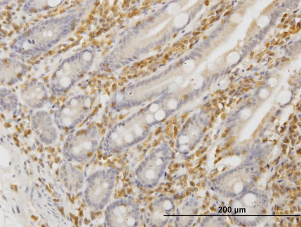 Monoclonal Mouse anti-Human HCLS1 Antibody (clone 2A9, IHC, IF, WB)