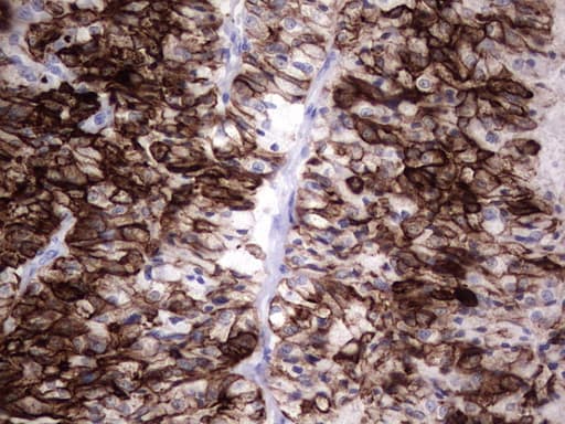 KRT19 / CK19 / Cytokeratin 19 Antibody (aa240-390, clone OTI8A1)