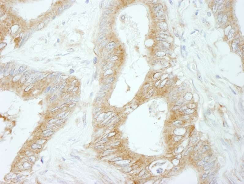 Polyclonal Rabbit anti-Human FLII / FLI Antibody (aa425-475, IHC, IF)