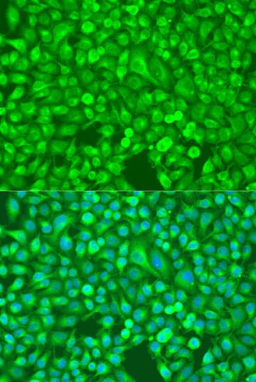NFKB2 Antibody