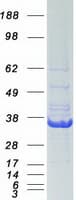 Human ERCC1 Protein (Recombinant Myc-DDK (Flag))