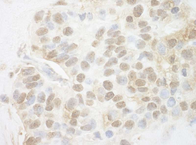 PYGO2 / Pygopus 2 Antibody (aa1-50)