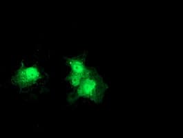 Thymidylate Kinase Antibody (clone OTI1H4)