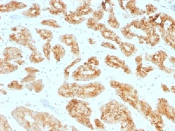 AMACR / P504S Antibody (clone AMACR/1723, Azide-free, BSA-free)