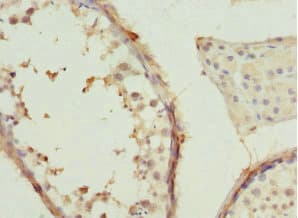 CCT2 / CCT Beta Antibody