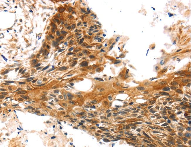 TRIM35 Antibody