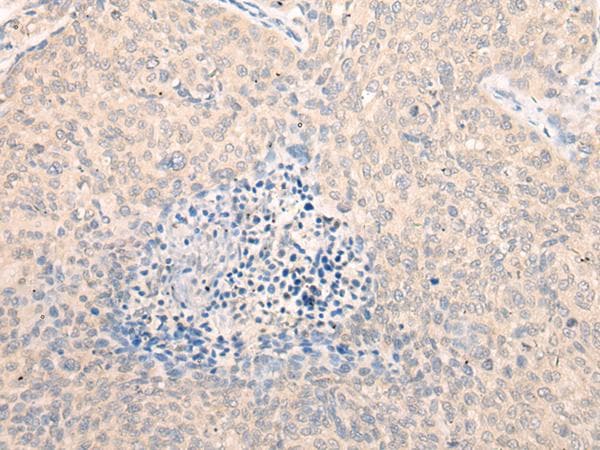 SEPT10 /Septin 10 Antibody