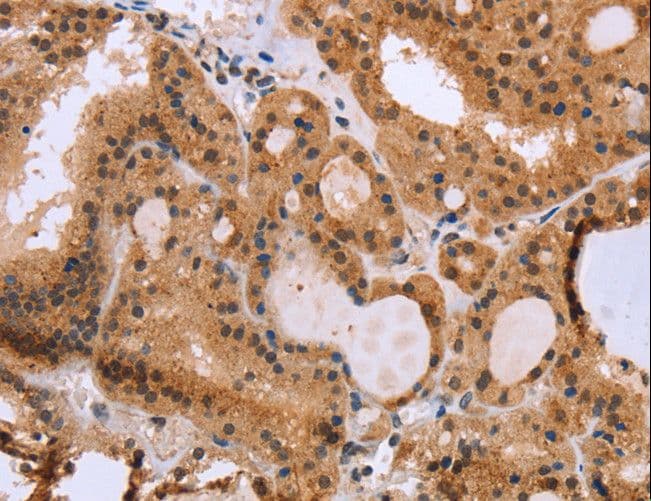 IHC-plus™ Polyclonal Rabbit anti-Human EPDR / EPDR1 Antibody (IHC, WB)