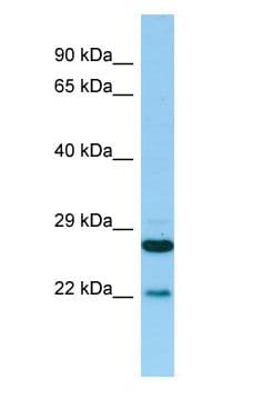 Polyclonal Rabbit anti-Human PTGES2 Antibody (N-Terminus, WB)