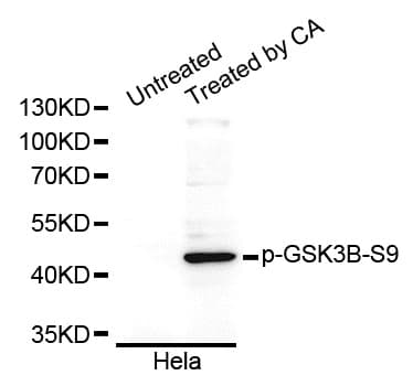 Polyclonal Rabbit anti-Human GSK3B / GSK3 Beta Antibody (phospho-Ser9, WB)