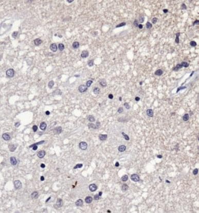 SERF1A / SERF1 Antibody