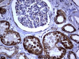 PIK3CD / PI3K Delta Antibody (aa286-610, clone OTI2D9)
