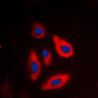 GALK1 / GK1 Antibody (N-Terminus)