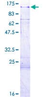 Human KSR2 Protein (Recombinant GST)
