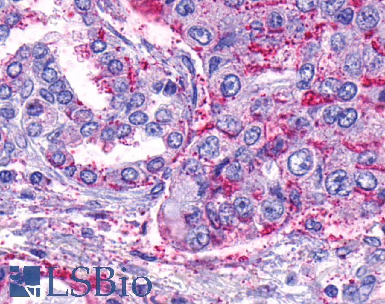 PathPlus™ F2R / Thrombin Receptor / PAR1 Antibody (N-Terminus)